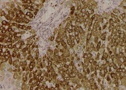 Invitrogen Phospho-ULK1 (Ser450) Polyclonal Antibody 100 &mu;L; Unconjugated:Antibodies,