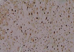 Invitrogen Phospho-ULK1 (Thr1046) Polyclonal Antibody 100 μL; Unconjugated:Antibodies,
