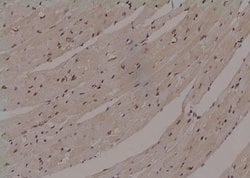 Invitrogen Phospho-ULK1 (Thr1046) Polyclonal Antibody 100 μL; Unconjugated:Antibodies,