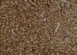 Invitrogen Phospho-ULK1 (Thr1046) Polyclonal Antibody 100 μL; Unconjugated:Antibodies,