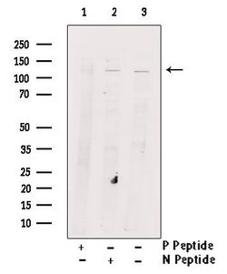 Invitrogen Phospho-ULK1 (Thr1046) Polyclonal Antibody 100 μL; Unconjugated:Antibodies,