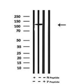 Invitrogen Phospho-ULK1 (Thr1046) Polyclonal Antibody 100 μL; Unconjugated:Antibodies,