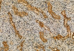 Invitrogen Phospho-IRE1 alpha (Ser724) Polyclonal Antibody 100 &mu;L; Unconjugated:Antibodies,