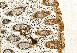 Invitrogen Phospho-IRE1 alpha (Ser724) Polyclonal Antibody 100 &mu;L; Unconjugated:Antibodies,