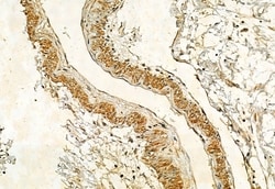 Invitrogen Phospho-IRE1 alpha (Ser724) Polyclonal Antibody 100 &mu;L; Unconjugated:Antibodies,