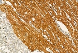 Invitrogen Phospho-IRE1 alpha (Ser724) Polyclonal Antibody 100 &mu;L; Unconjugated:Antibodies,