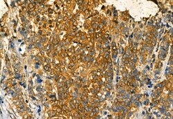 Invitrogen Phospho-IRE1 alpha (Ser724) Polyclonal Antibody 100 &mu;L; Unconjugated:Antibodies,