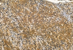 Invitrogen Phospho-IRE1 alpha (Ser724) Polyclonal Antibody 100 &mu;L; Unconjugated:Antibodies,
