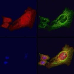 Invitrogen Phospho-IRE1 alpha (Ser724) Polyclonal Antibody 100 &mu;L; Unconjugated:Antibodies,