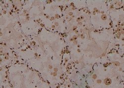 Invitrogen Phospho-IRE1 alpha (Ser724) Polyclonal Antibody 100 &mu;L; Unconjugated:Antibodies,