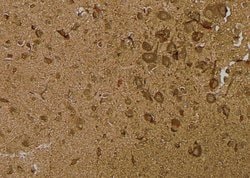 Invitrogen Phospho-IRE1 alpha (Ser724) Polyclonal Antibody 100 &mu;L; Unconjugated:Antibodies,