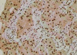 Invitrogen Phospho-IRE1 alpha (Tyr628) Polyclonal Antibody 100 &mu;L; Unconjugated:Antibodies,