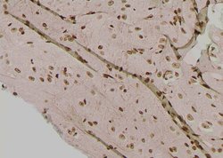 Invitrogen Phospho-IRE1 alpha (Tyr628) Polyclonal Antibody 100 &mu;L; Unconjugated:Antibodies,