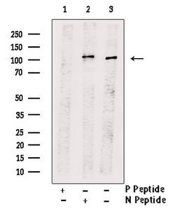 Invitrogen Phospho-IRE1 alpha (Tyr628) Polyclonal Antibody 100 &mu;L; Unconjugated:Antibodies,