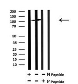 Invitrogen Phospho-IRE1 alpha (Tyr628) Polyclonal Antibody 100 &mu;L; Unconjugated:Antibodies,