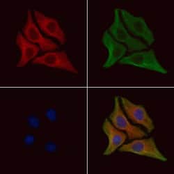 Invitrogen Phospho-DR6 (Thr460) Polyclonal Antibody 100 &mu;L; Unconjugated:Antibodies,