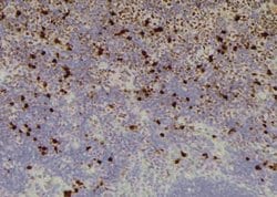 Invitrogen Phospho-SF3B1 (Thr211) Polyclonal Antibody 100 μL; Unconjugated:Antibodies,