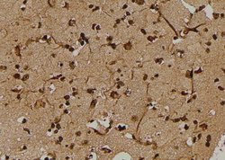 Phospho-DAB1 (Tyr198) Polyclonal Antibody:Antibodies, Polyclonal