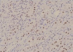 Invitrogen Phospho-MSK2 (Thr687) Polyclonal Antibody 100 &mu;L; Unconjugated:Antibodies,