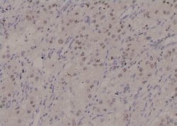 Invitrogen Phospho-STAM2 (Tyr371) Polyclonal Antibody 100 &mu;L; Unconjugated:Antibodies,