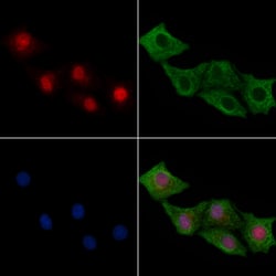 Invitrogen Phospho-NFAT5 (Ser145) Polyclonal Antibody 100 μL; Unconjugated:Antibodies,