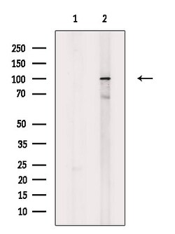 Invitrogen Phospho-KIF20A (Tyr869) Polyclonal Antibody 100 &mu;L; Unconjugated:Antibodies,
