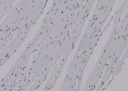 Invitrogen Phospho-KIF20A (Tyr869) Polyclonal Antibody 100 &mu;L; Unconjugated:Antibodies,