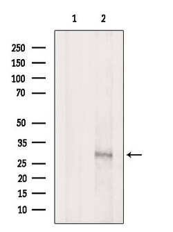 Invitrogen Phospho-MPZL1 (Tyr241) Polyclonal Antibody 100 &mu;L | Buy Online | Invitrogen&trade; | Fisher Scientific