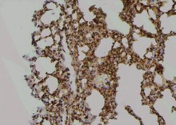 Invitrogen Phospho-MPZL1 (Tyr241) Polyclonal Antibody 100 &mu;L | Buy Online | Invitrogen&trade; | Fisher Scientific