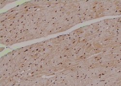 Invitrogen Phospho-MPZL1 (Tyr241) Polyclonal Antibody 100 &mu;L | Buy Online | Invitrogen&trade; | Fisher Scientific