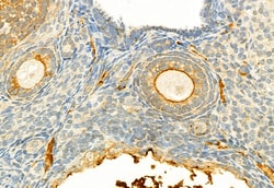 Invitrogen Phospho-LATS1 (Thr1079) Polyclonal Antibody 100 &mu;L; Unconjugated:Antibodies,