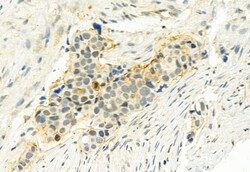 Invitrogen Phospho-LATS1 (Thr1079) Polyclonal Antibody 100 &mu;L; Unconjugated:Antibodies,