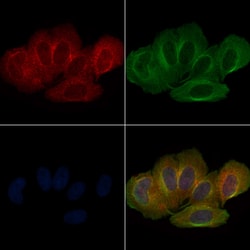 Invitrogen Phospho-LATS1 (Ser909) Polyclonal Antibody 100 &mu;L; Unconjugated:Antibodies,