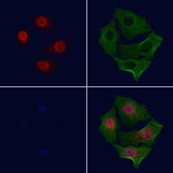 Invitrogen Phospho-c-Myc (Ser293) Polyclonal Antibody 100 &mu;L | Buy Online | Invitrogen&trade; | Fisher Scientific