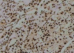 Invitrogen Phospho-CD25 (Ser268) Polyclonal Antibody 100 &mu;L | Buy Online | Invitrogen&trade; | Fisher Scientific