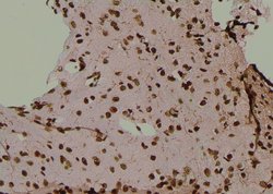 Invitrogen Phospho-CD25 (Ser268) Polyclonal Antibody 100 &mu;L | Buy Online | Invitrogen&trade; | Fisher Scientific