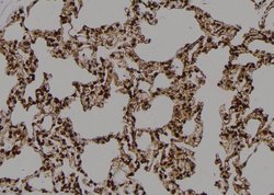 Invitrogen Phospho-CD25 (Ser268) Polyclonal Antibody 100 &mu;L | Buy Online | Invitrogen&trade; | Fisher Scientific