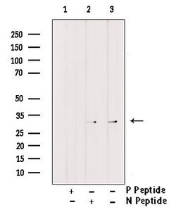Invitrogen Phospho-CD25 (Ser268) Polyclonal Antibody 100 &mu;L | Buy Online | Invitrogen&trade; | Fisher Scientific