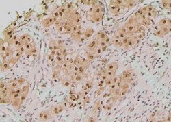 Invitrogen Phospho-TK1 (Tyr181) Polyclonal Antibody 100 μL; Unconjugated:Antibodies,