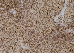 Invitrogen Phospho-TK1 (Tyr181) Polyclonal Antibody 100 μL; Unconjugated:Antibodies,