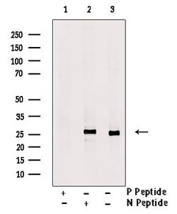 Invitrogen Phospho-TK1 (Tyr181) Polyclonal Antibody 100 μL; Unconjugated:Antibodies,