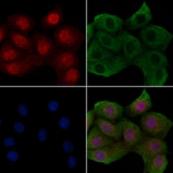 Invitrogen Phospho-ErbB2 (HER-2) (Tyr1005) Polyclonal Antibody 100 μL;