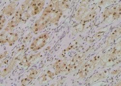 Invitrogen Phospho-ErbB2 (HER-2) (Tyr1005) Polyclonal Antibody 100 μL;