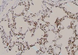 Invitrogen Phospho-ErbB2 (HER-2) (Tyr1005) Polyclonal Antibody 100 μL;