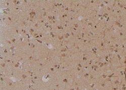Invitrogen Phospho-TrkA (Tyr791) Polyclonal Antibody 100 μL; Unconjugated:Antibodies,