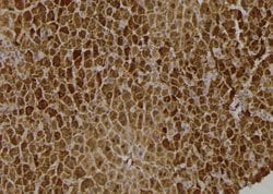Invitrogen Phospho-TrkA (Tyr791) Polyclonal Antibody 100 μL; Unconjugated:Antibodies,