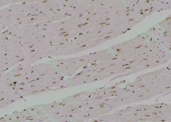 Invitrogen Phospho-TrkA (Tyr791) Polyclonal Antibody 100 μL; Unconjugated:Antibodies,