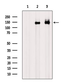 Invitrogen Phospho-Amyloid Precursor Protein (Tyr757) Polyclonal Antibody 100 &mu;L | Buy Online | Invitrogen&trade; | Fisher Scientific
