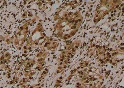 Invitrogen Phospho-Amyloid Precursor Protein (Tyr757) Polyclonal Antibody 100 &mu;L | Buy Online | Invitrogen&trade; | Fisher Scientific