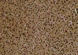 Invitrogen Phospho-Amyloid Precursor Protein (Tyr757) Polyclonal Antibody 100 &mu;L | Buy Online | Invitrogen&trade; | Fisher Scientific